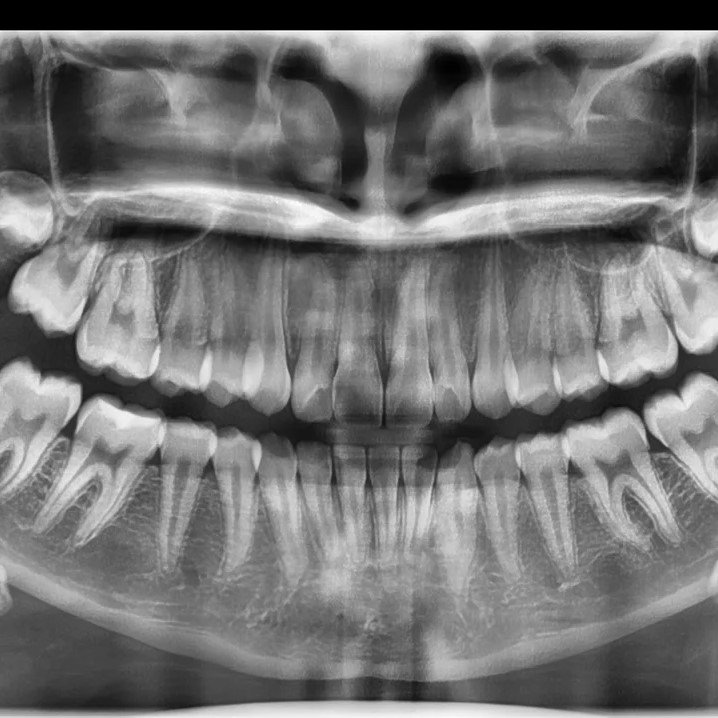 Radiografia-Panoramica–scaled
