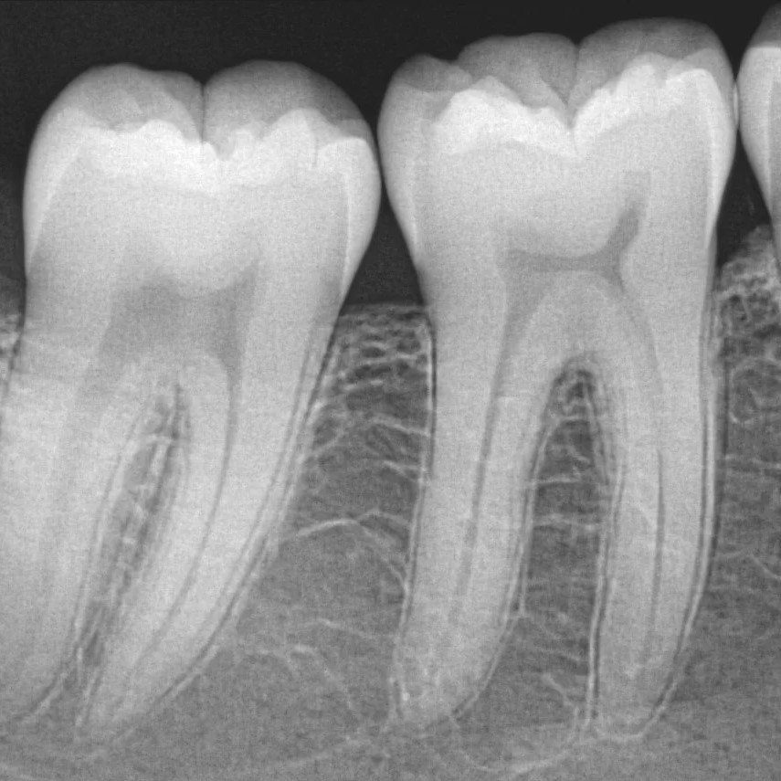Radiografia-Periapical