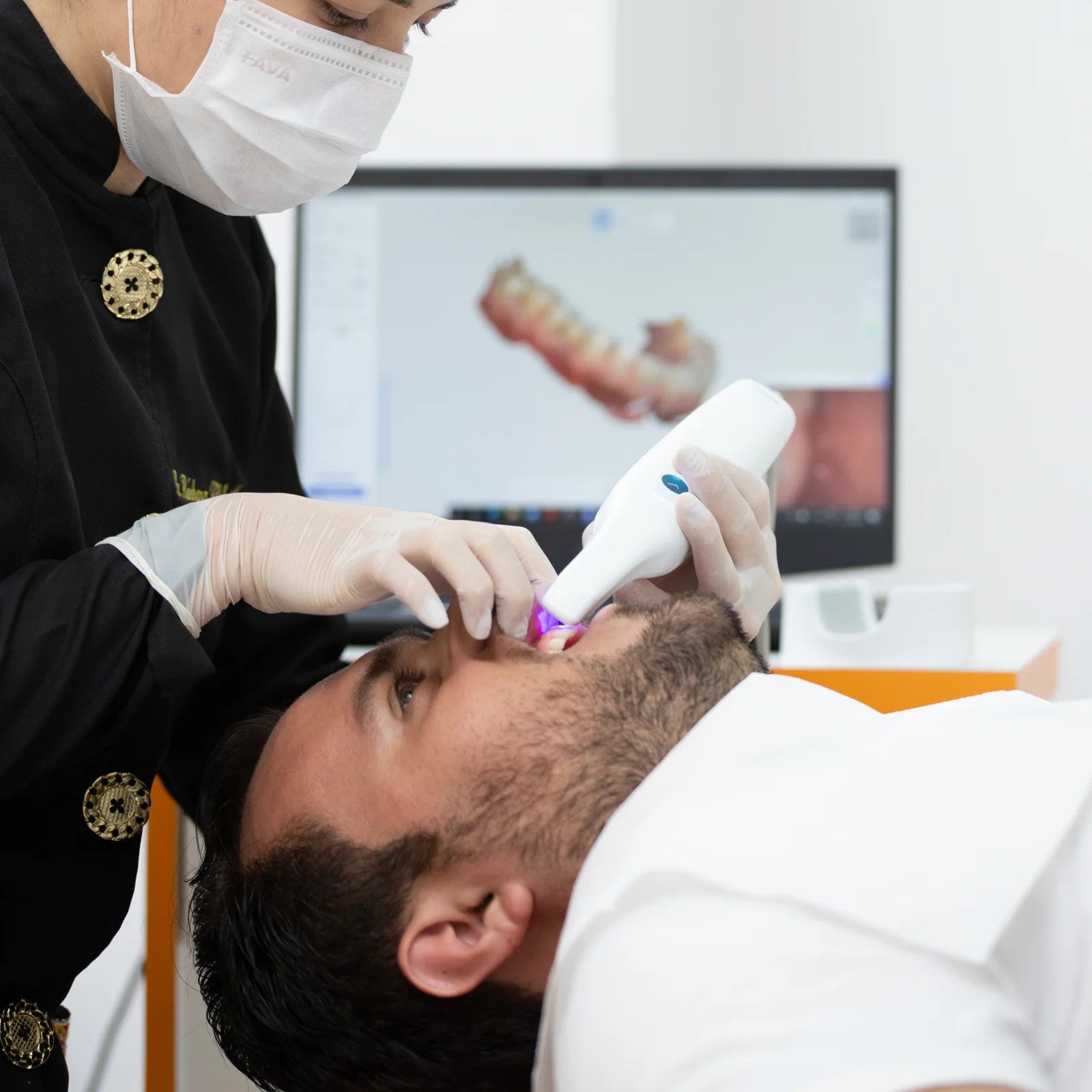 Scanner-Intra-Oral-